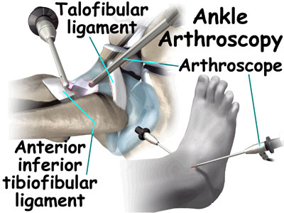 arthoscopic clinic at Chhabra Hospital