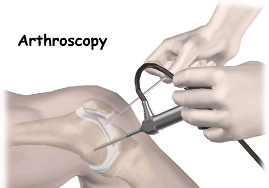 arthoscopic clinic at Chhabra Hospital