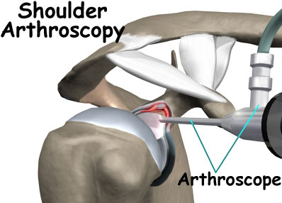 arthoscopic clinic at Chhabra Hospital